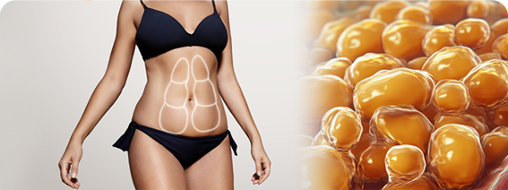 체지방 위주 감량