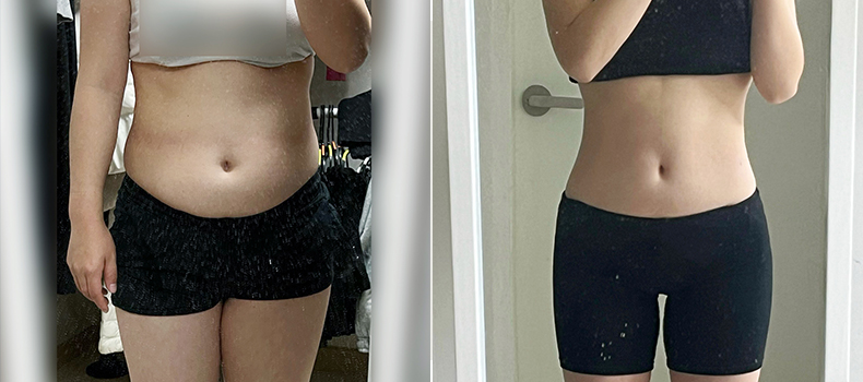 후 치료 케이스