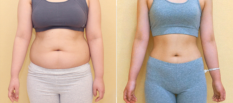 후 치료 케이스