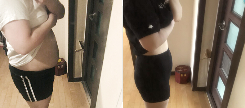 후 치료 케이스