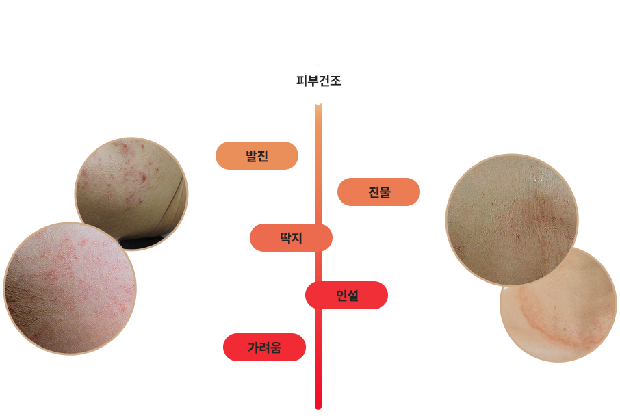넓은 스펙트럼의 피부 치료 공식